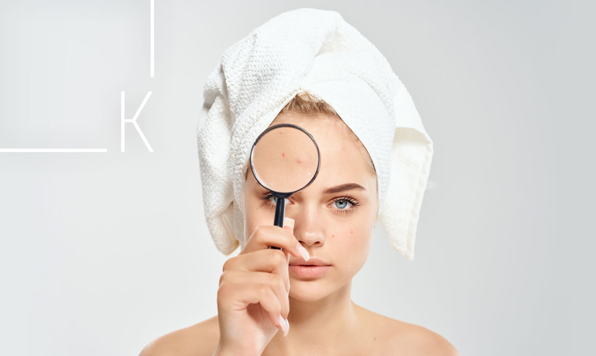 Лечение на белези от акне | Ние от K AESTHETICS намерихме рецептата и нямаме търпение да я споделим с клиентите си. | K AESTHETICS