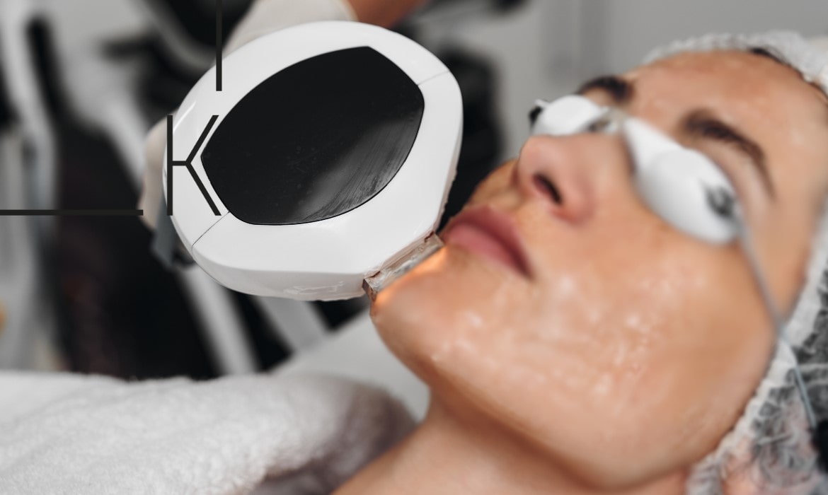 IPL LUMECCA Терапия | Ние от K AESTHETICS намерихме рецептата и нямаме търпение да я споделим с клиентите си. | K AESTHETICS