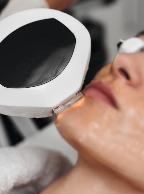 IPL LUMECCA Терапия | Ние от K AESTHETICS намерихме рецептата и нямаме търпение да я споделим с клиентите си. | K AESTHETICS